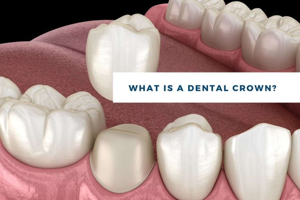 What is a dental crown, and why do I need one?