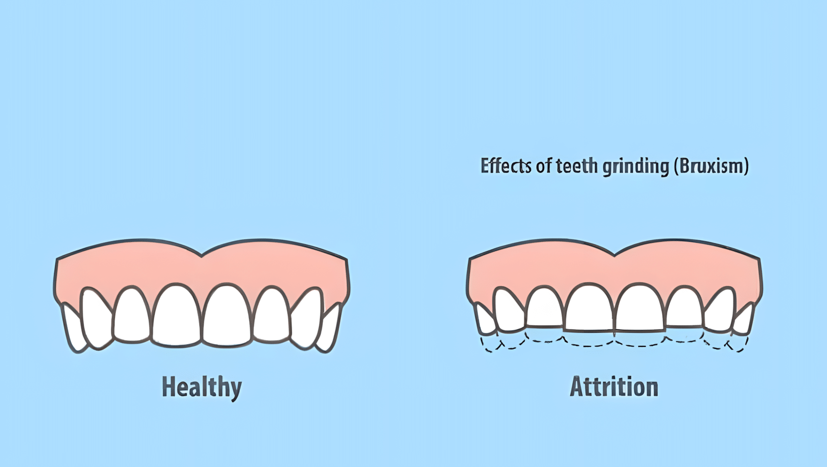 bruxism dental office.jpg upscayl 2x upscayl standard 4x