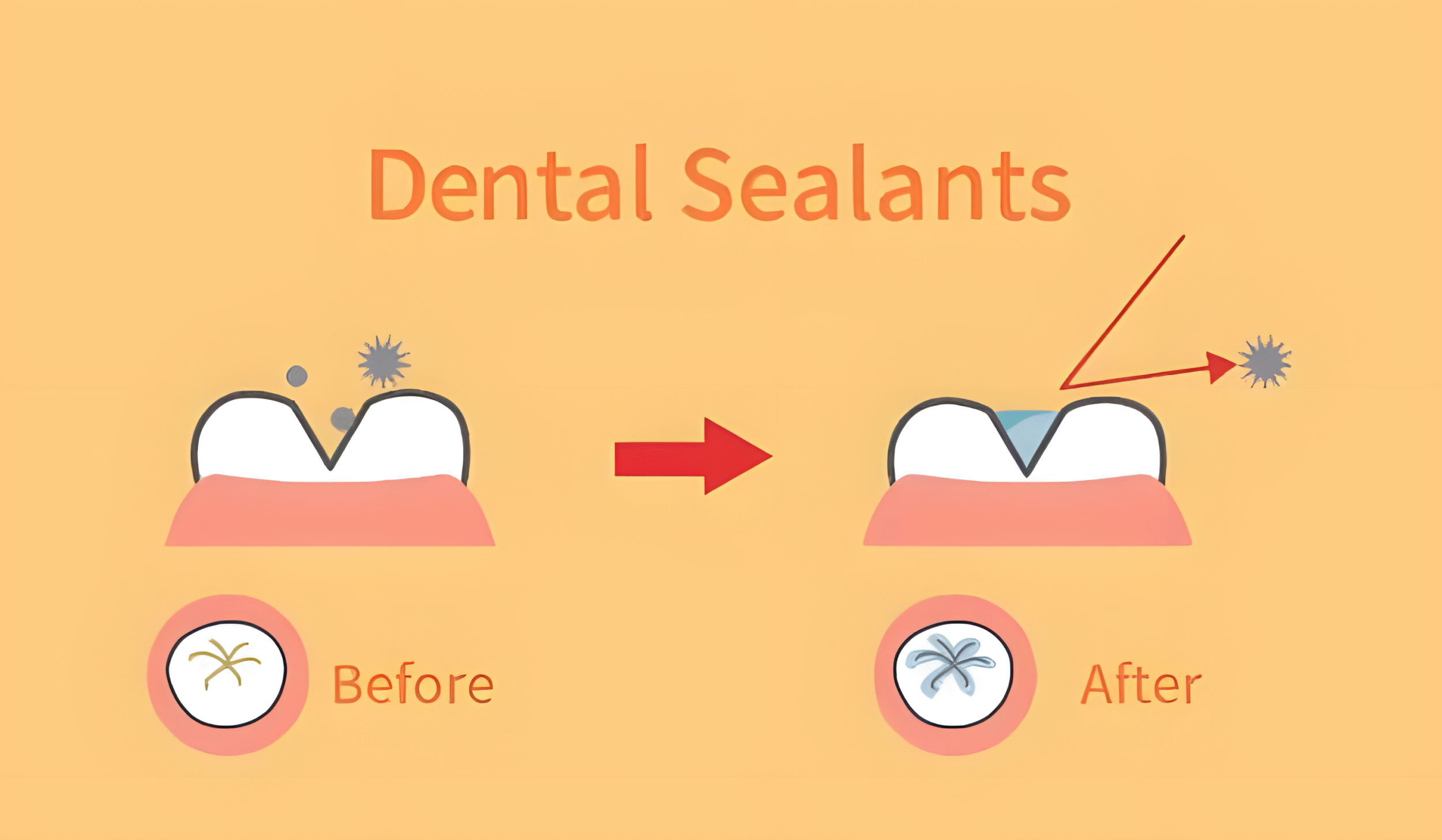 1739216129 sealants 1 upscayl 4x upscayl standard 4x 1739216129 sealants 1 upscayl 4x upscayl standard 4x