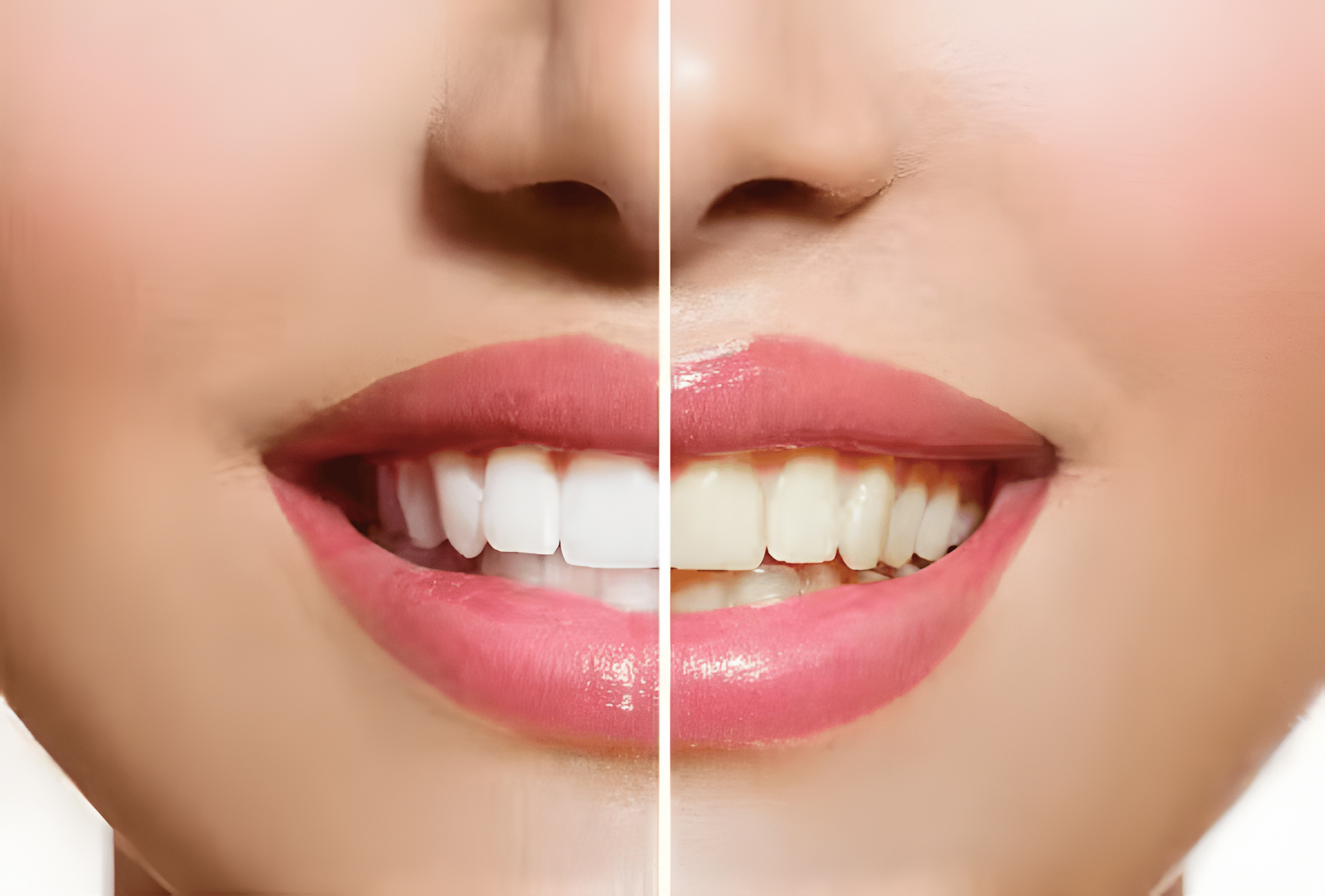 1739216159 cosmetic dentistry 1.jpg upscayl 4x upscayl standard 4x