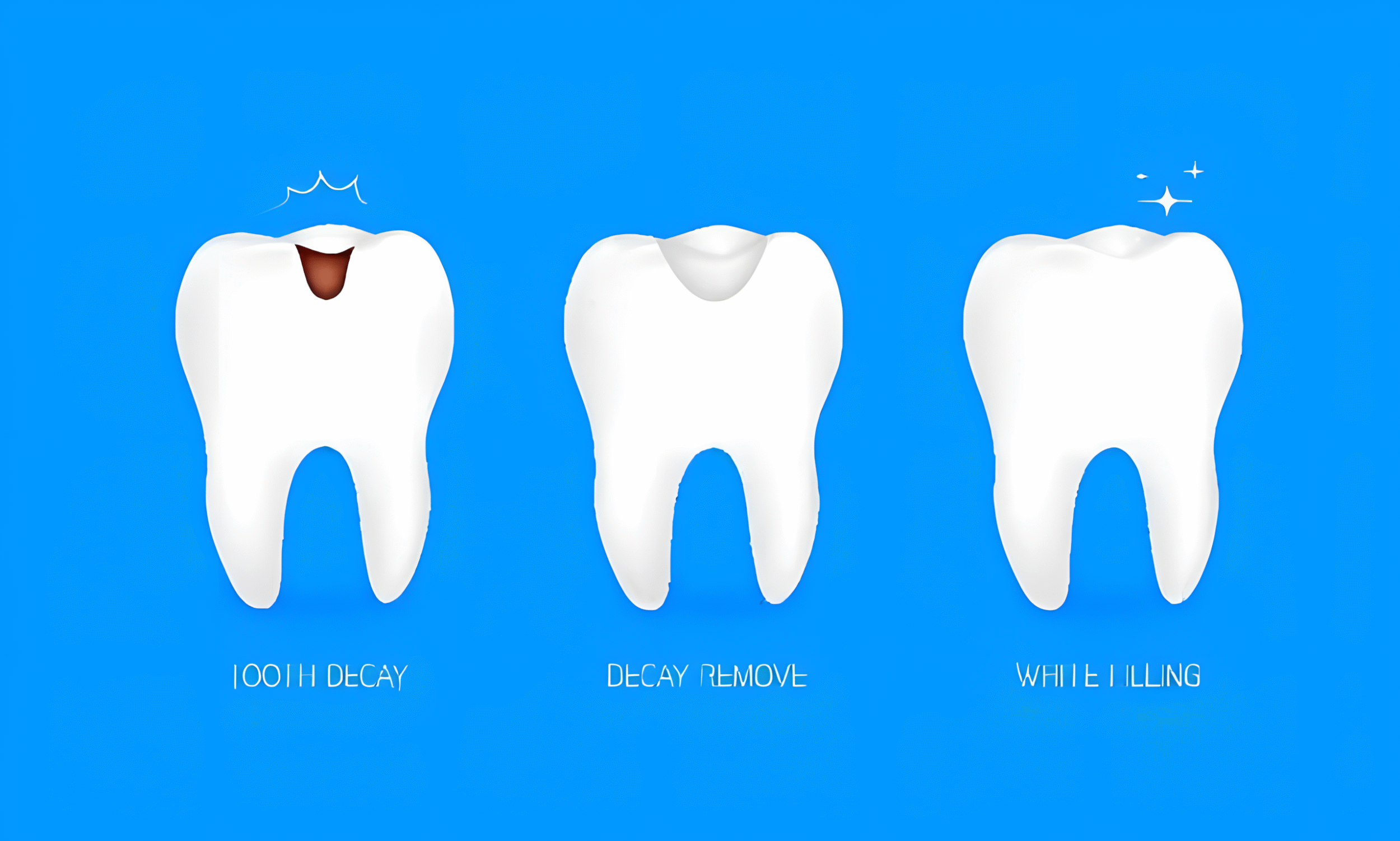 1739216104 fillings 1.jpg 1 upscayl 2x upscayl standard 4x